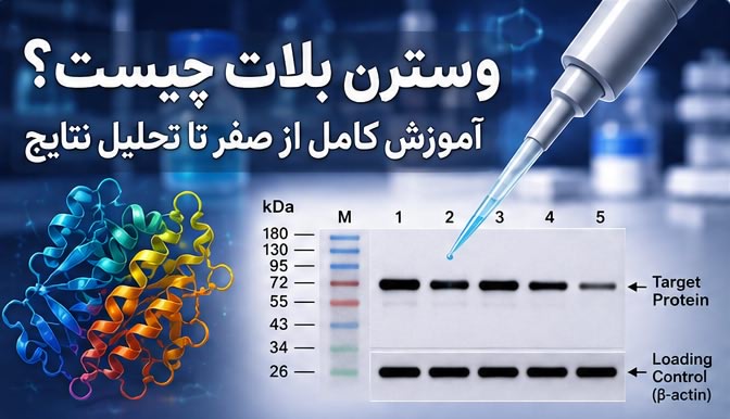 وسترن بلات چیست؟ آموزش کامل از صفر تا تحلیل نتایج آزمایشگاهی Western Blot وسترن بلات چیست؟ آموزش کامل از صفر تا تحلیل نتایج آزمایشگاهی Western Blot