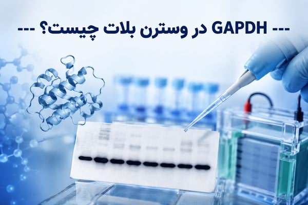GAPDH در وسترن بلات چیست؟ GAPDH در وسترن بلات چیست؟