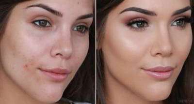 روش صحیح و حرفهای پوشاندن جوش و آکنه به کمک مواد آرایشی روش صحیح و حرفهای پوشاندن جوش و آکنه به کمک مواد آرایشی