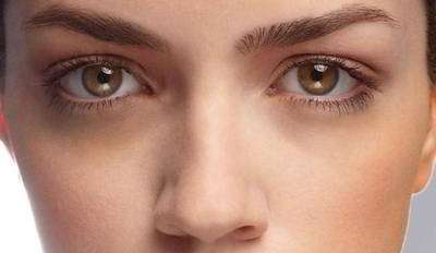 تیرگیهای اطراف چشم را با تصحیح رنگ به این شکل کاملا محو کنید تیرگیهای اطراف چشم را با تصحیح رنگ به این شکل کاملا محو کنید