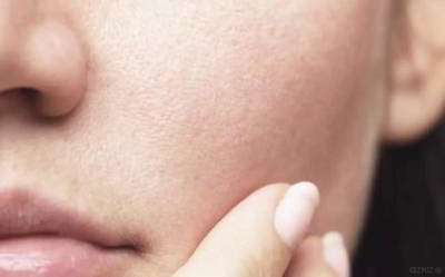 آیا پوست من کم آب است؟ از کجا متوجه کم آبی پوست شویم؟