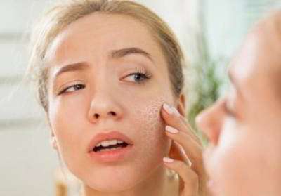 درمانهای طبیعی برای رفع خشکی پوست درمانهای طبیعی برای رفع خشکی پوست