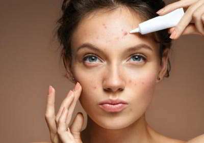 آموزش آرایش برای مبتلایان به اگزما آموزش آرایش برای مبتلایان به اگزما
