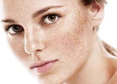 راهنمای کرم ضد لک راهنمای کرم ضد لک