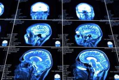 نشانههای بیماری مغز نشانههای بیماری مغز