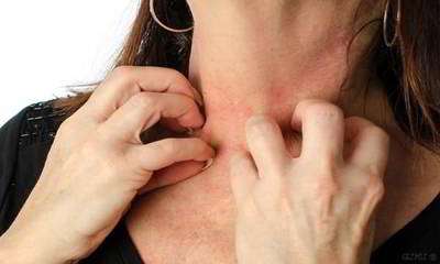 شوک آلرژیک