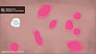 همه چیز درباره ی سرطان خون